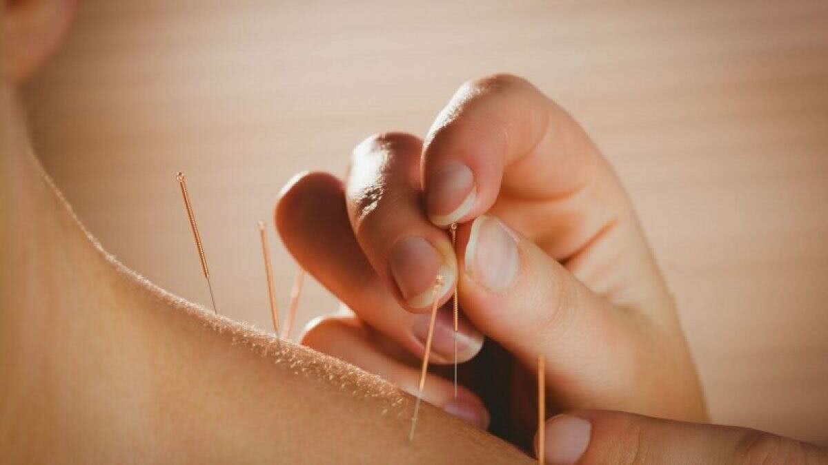 Dicas e Temas para TCC sobre Acupuntura